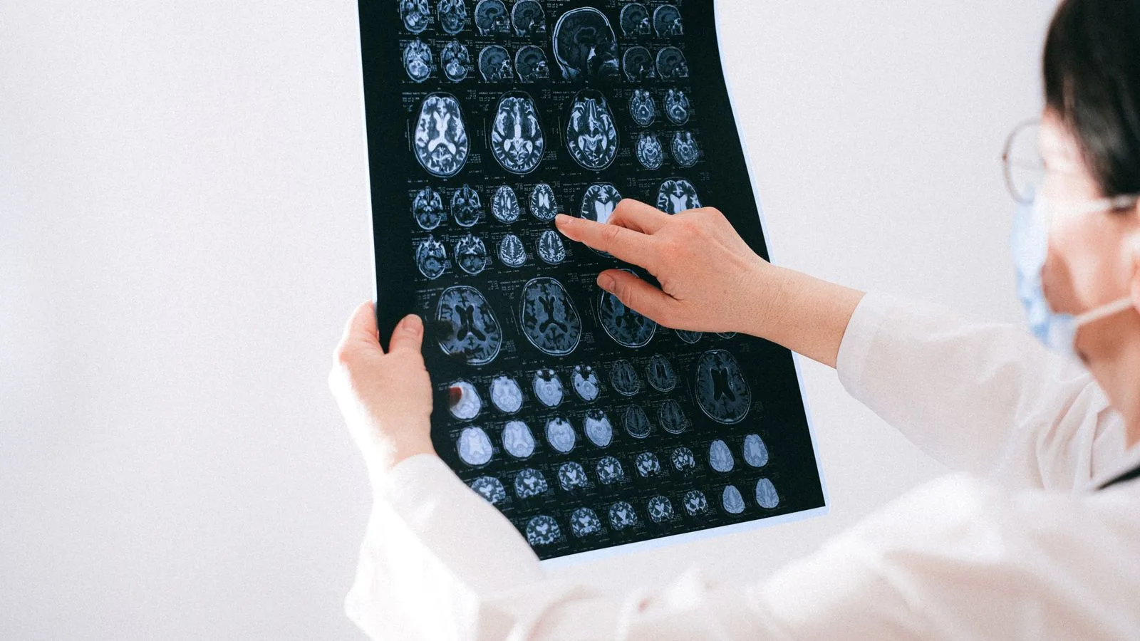 Médecin examinant une série d'images cérébrales sur un film d'IRM.